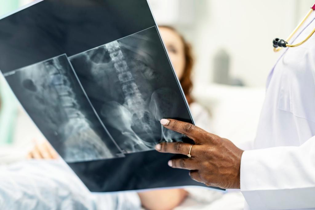 Doctor holding X-ray for health bones, not osteoporosis
