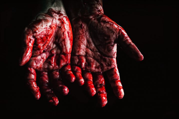 Bloody hands