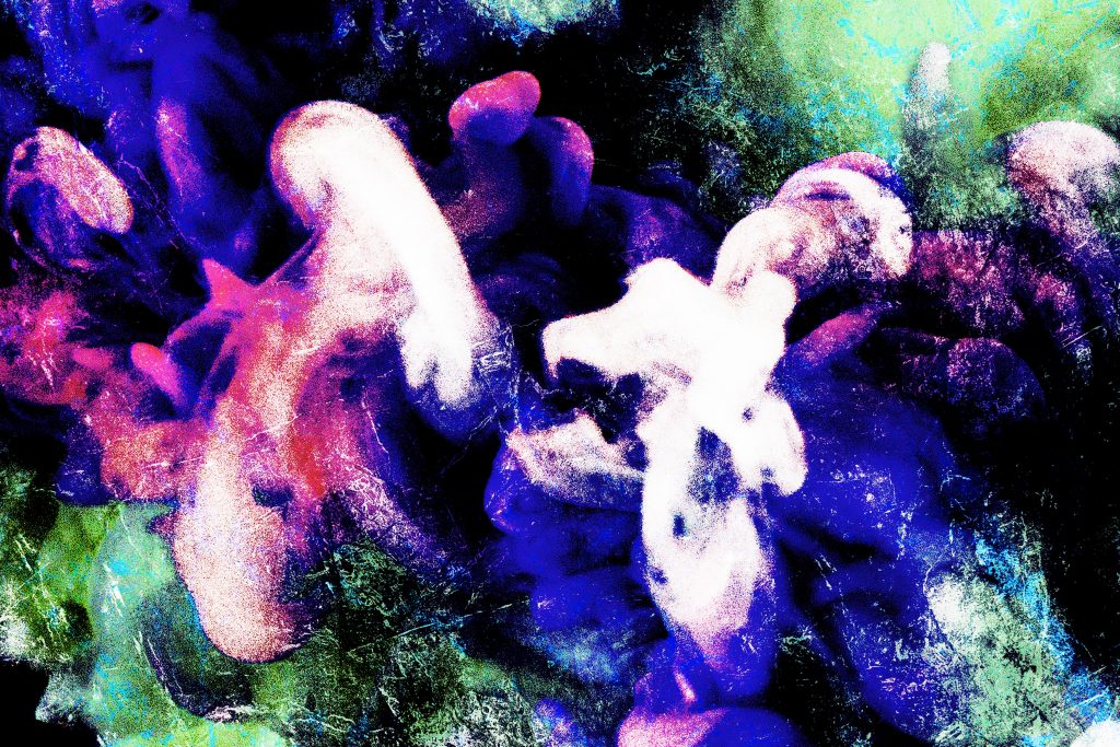 Guided Imagery can speed surgical recovery